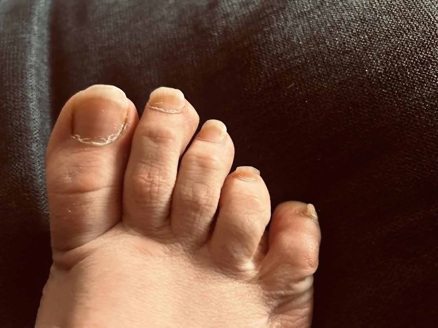Clipped Toenails From Real Worn Feet Natural & Personal