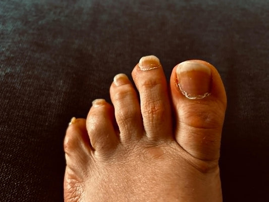 Clipped Toenails From Real Worn Feet Natural & Personal